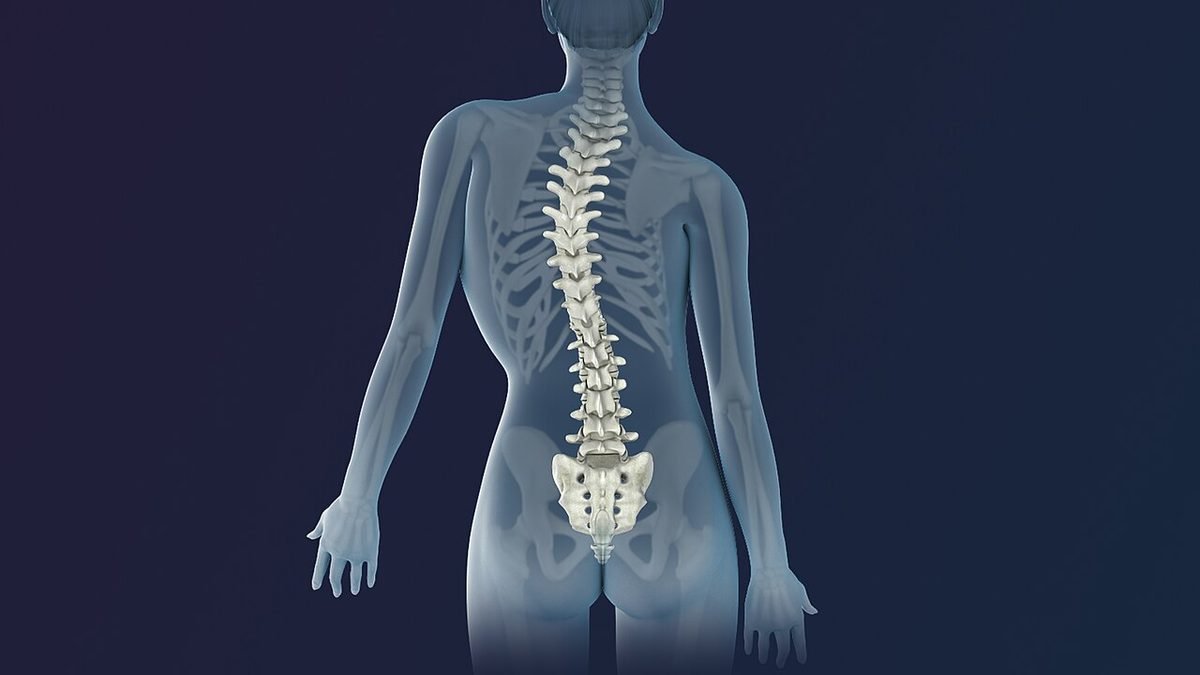 scoliosis diagram