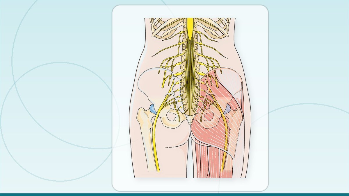 medical illustration: sciatic nerve