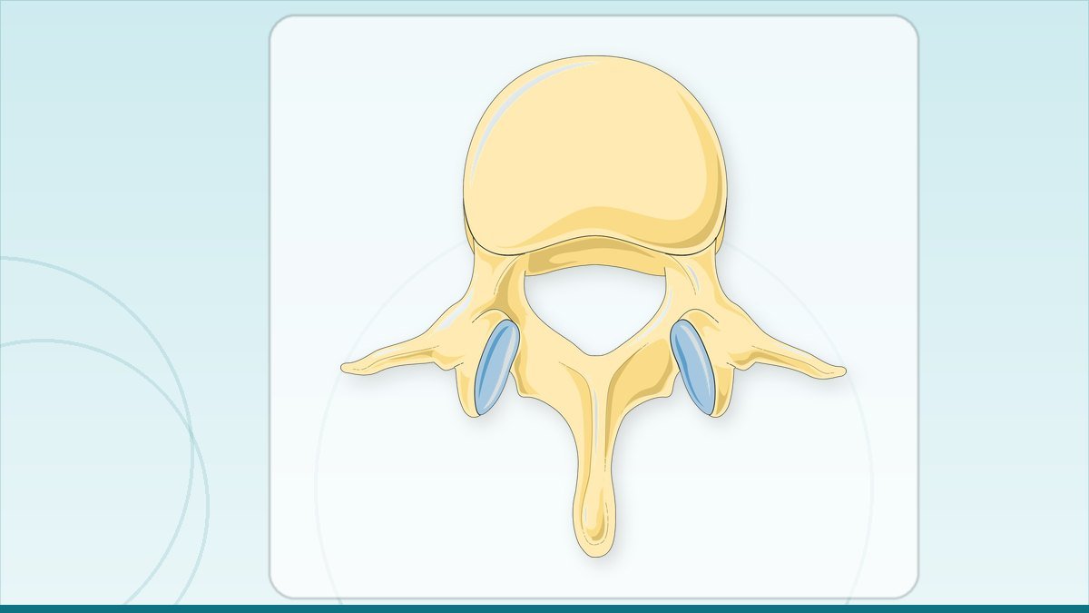 medical illustration of a lumbar vertebra and its facet joints