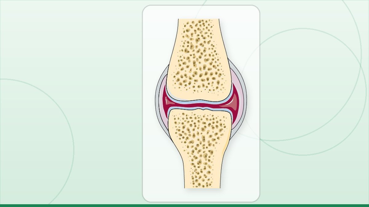 medical illustration: rheumatology - Normal joint