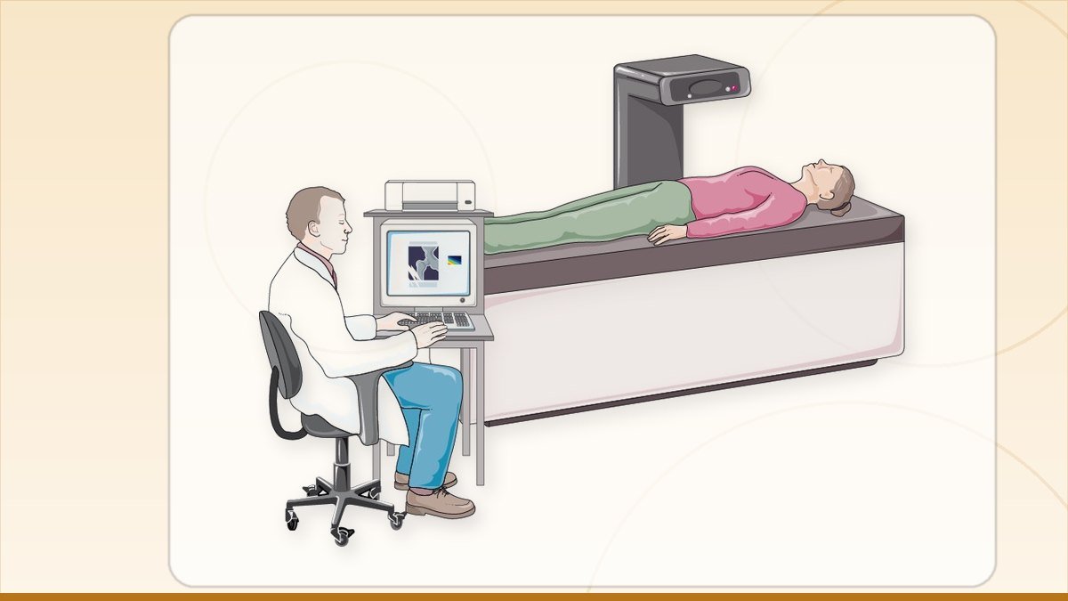 medical illustration: rheumatology - Osteodensitometry