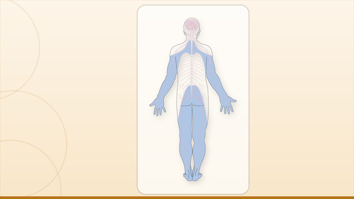 medical illustration: neuropathy