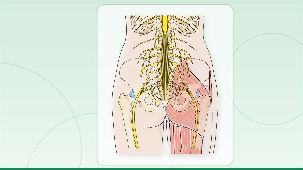 medical illustration: sciatic nerve