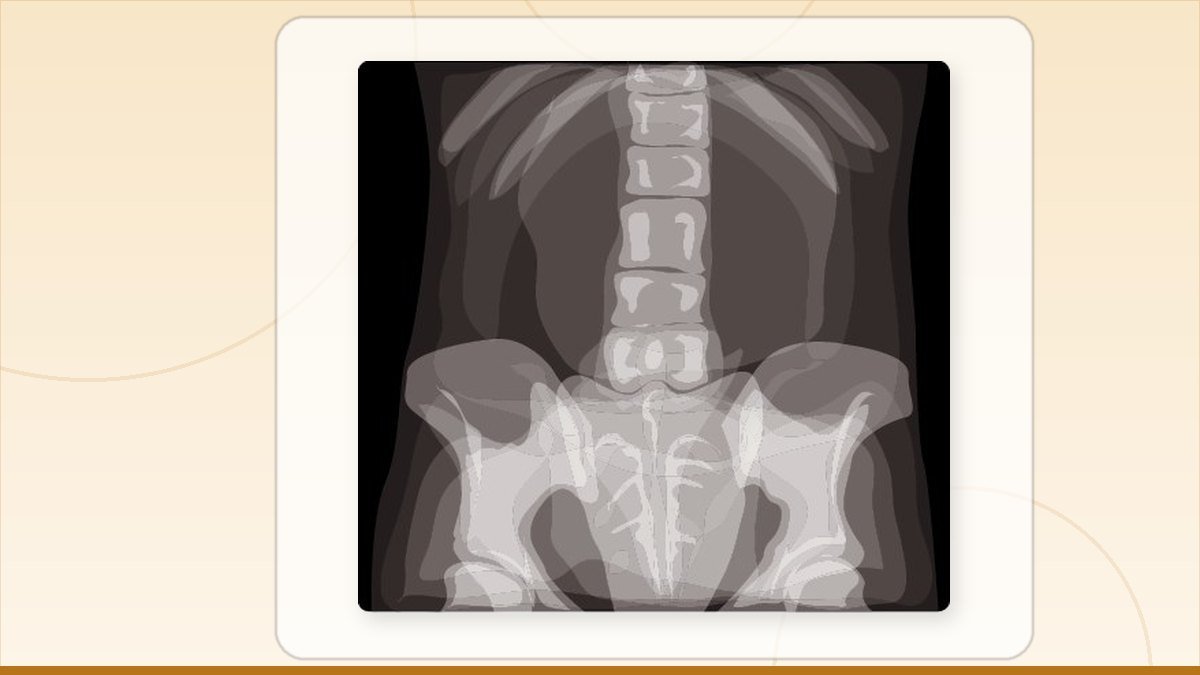 medical illustration: equipment - Radiography