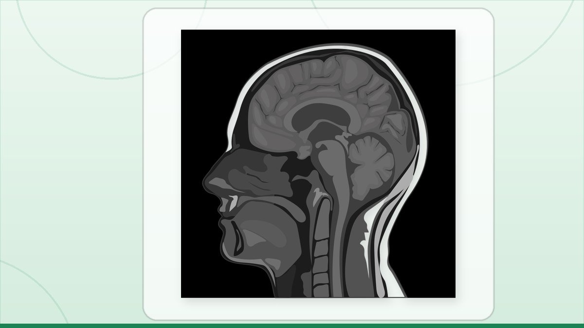 medical illustration: MRI Imaging