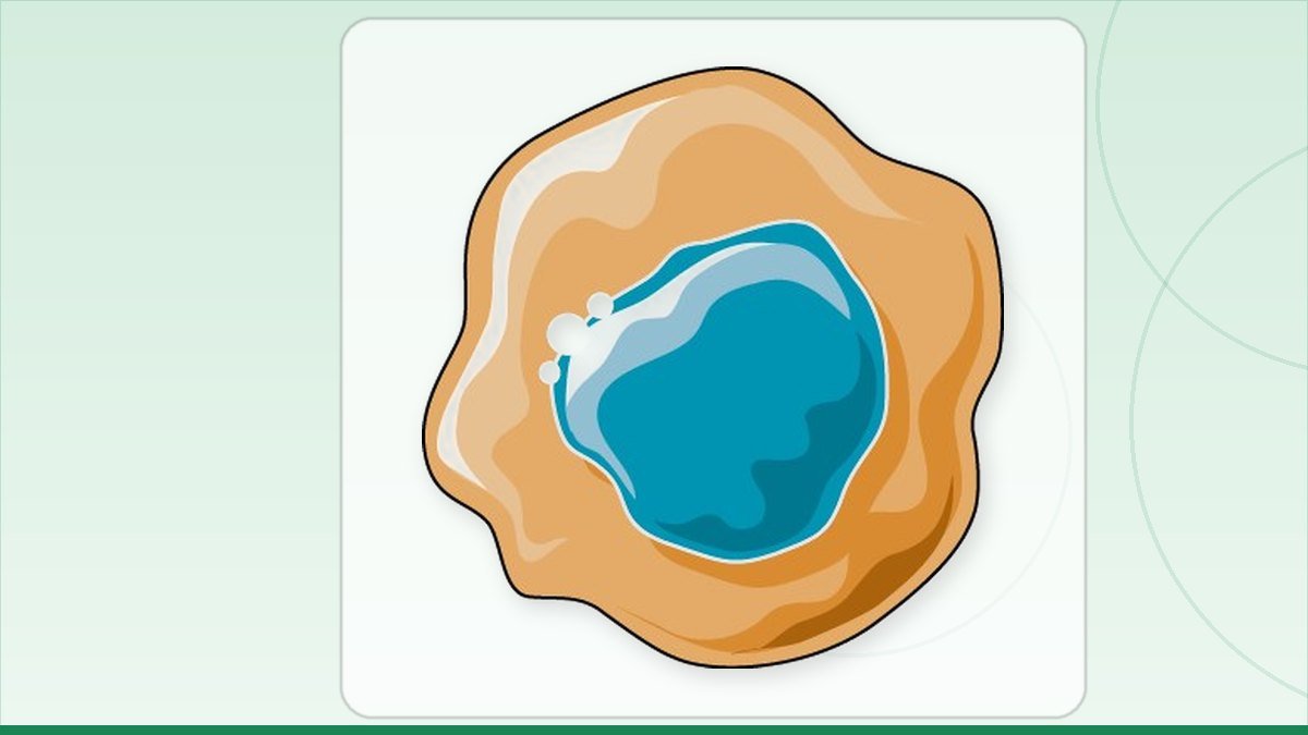 medical illustration: oncology - Cancerous cell
