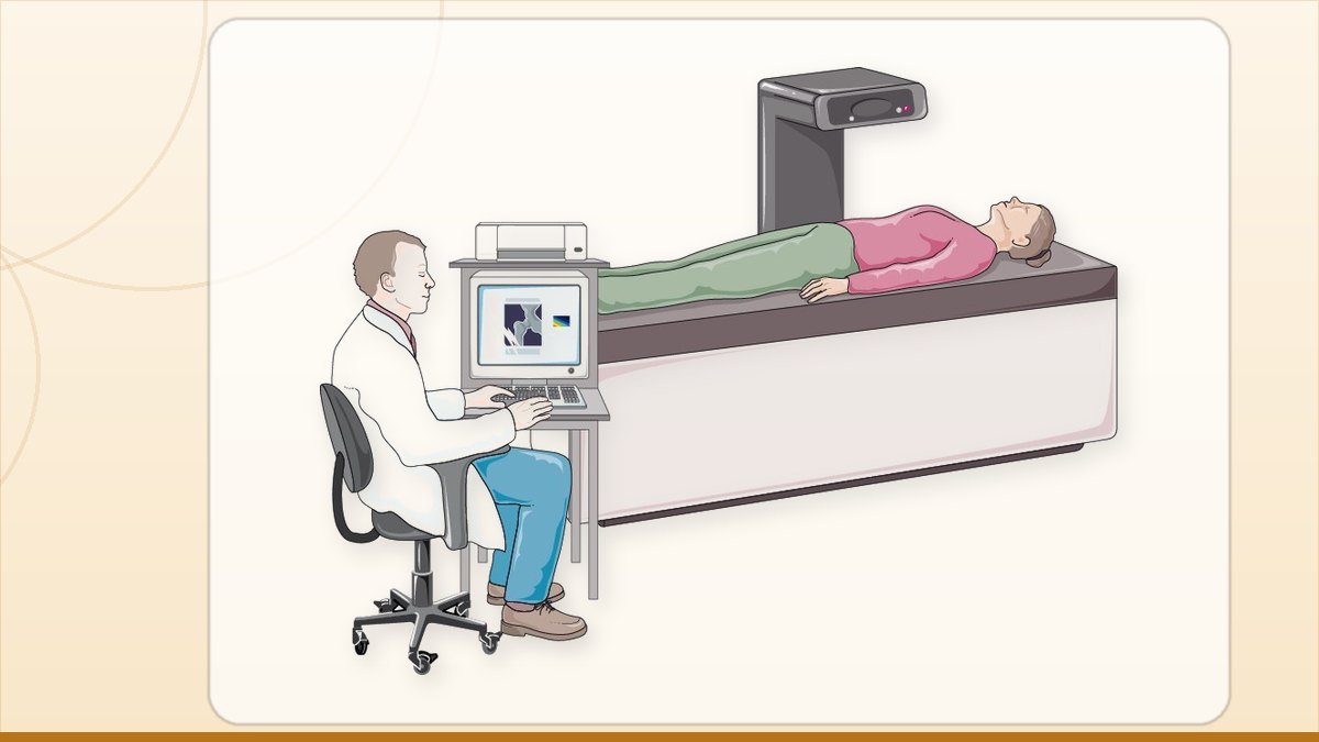 medical illustration: rheumatology - Osteodensitometry