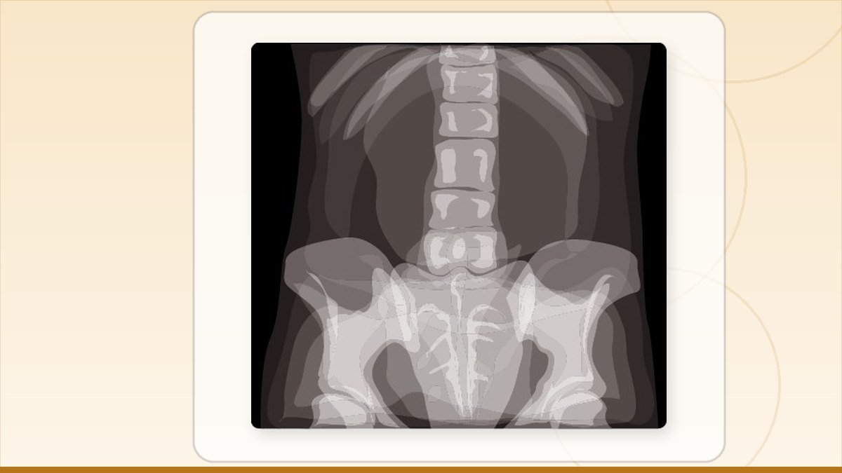 medical illustration: equipment - Radiography